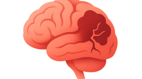 Cerebrovascular Diseases