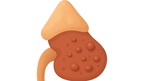 Adrenal cortical diseases