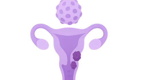 HPV-associated cancers