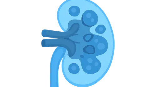 Nephrotic syndrome