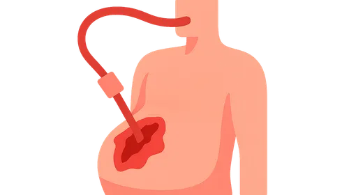 Abdominal Trauma Management