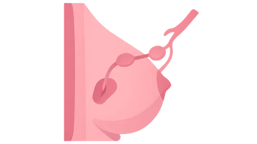 Sentinel Lymph Node Biopsy