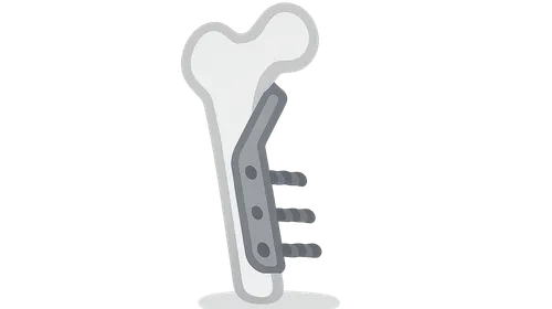 Clinical Applications of Biomechanics