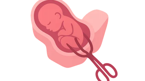 Instrumental Deliveries