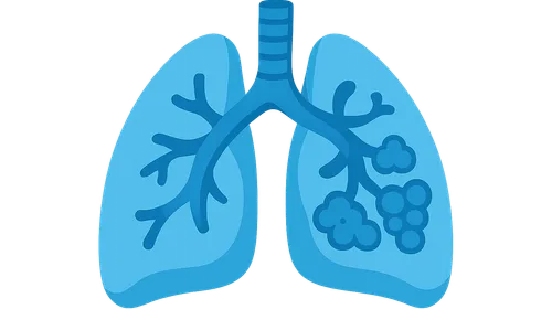 Chronic Obstructive Pulmonary Disease