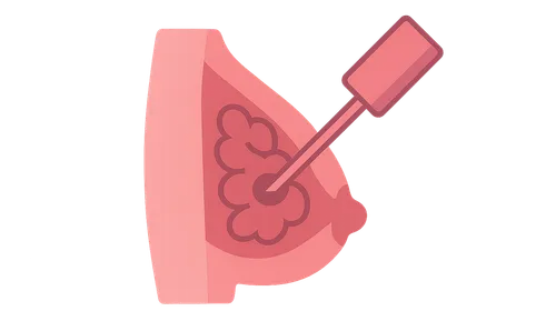 Interventional Breast Procedures