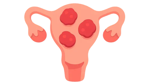 Sexually Transmitted Infections