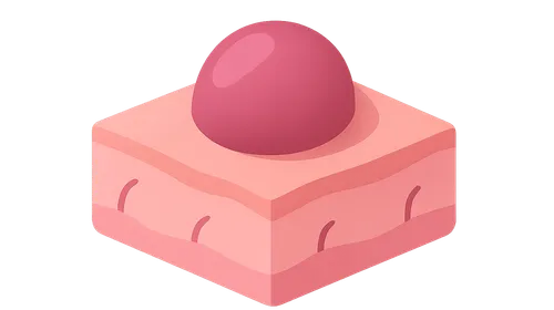 Merkel Cell Carcinoma