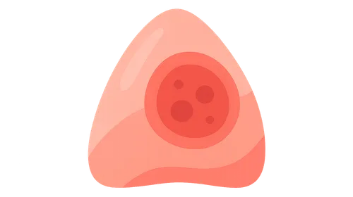 Molecular Imaging in Inflammation and Infection