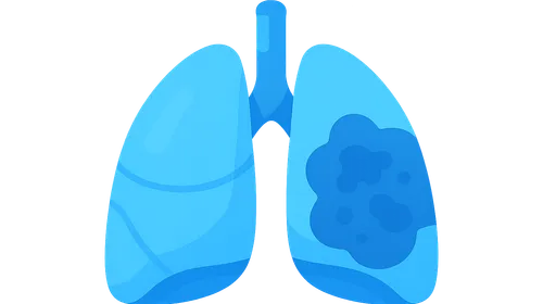 Pulmonary complications