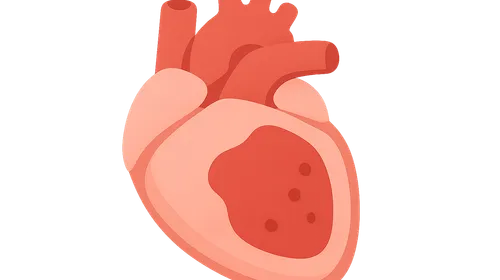 Pericardial Diseases