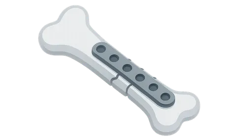 Plate Osteosynthesis