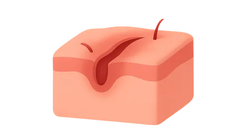 Wound Healing and Care