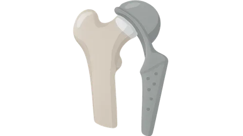 Pathology of Orthopedic Implants