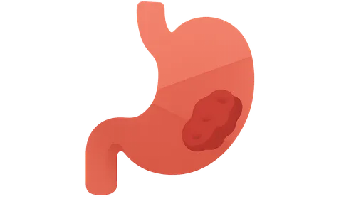 Gastrointestinal Malignancies