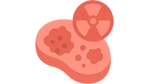 Radiation Carcinogenesis