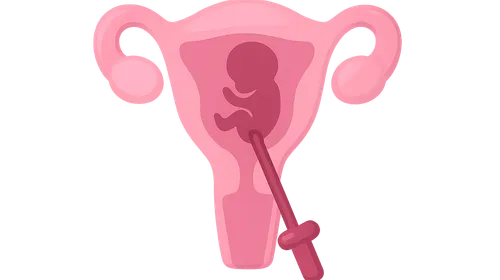 Medical Termination of Pregnancy