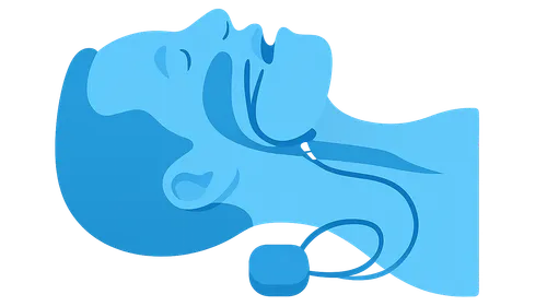 Upper Airway Stimulation Therapy