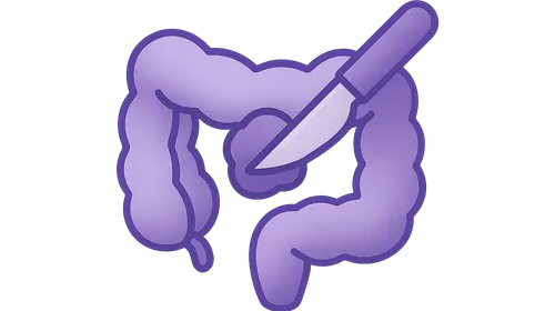 Cytoreductive Surgery