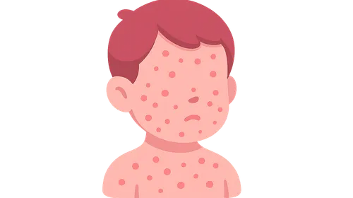 Pediatric Dermatology