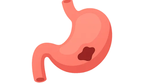 Gastrointestinal perforation