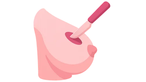 Benign breast disease management