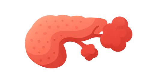 Systemic complications of acute pancreatitis