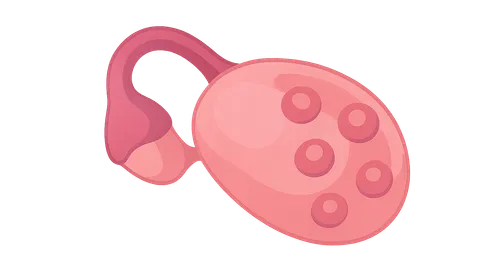 Polycystic Ovary Syndrome