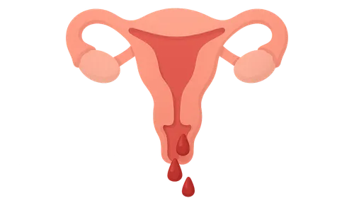 Abnormal Uterine Bleeding
