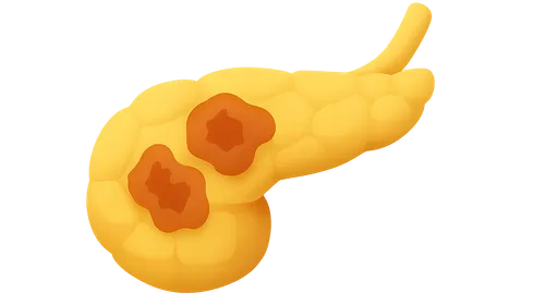 Chronic Pancreatitis