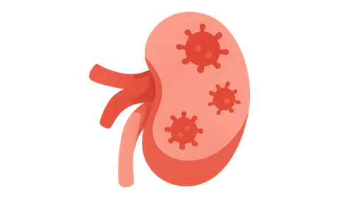 Post-transplant infections