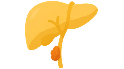 Biliary Tract Tumors