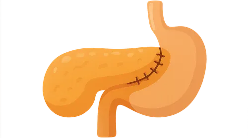 Pancreatic Anastomosis