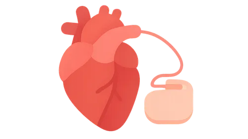 Device therapy for heart failure