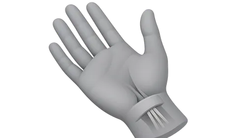 Carpal Tunnel Syndrome