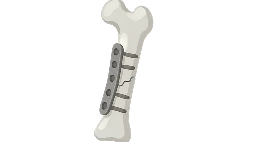 Surgical Considerations in Metabolic Bone Diseases