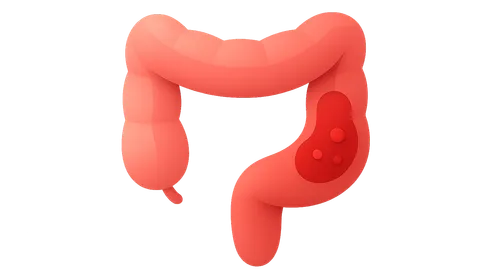 Postoperative Complications