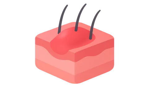 Patterns of inflammatory response