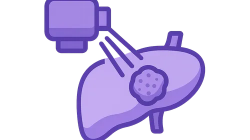 Intensity-Modulated Radiation Therapy