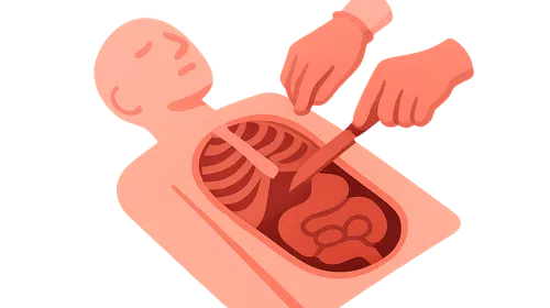 Internal Examination in Autopsy