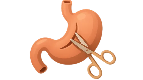 Gastrointestinal Surgery