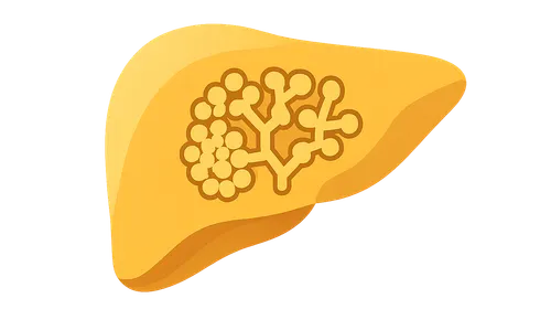 GSD type IV (Andersen disease)