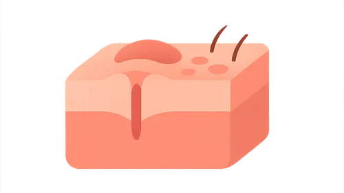 Phases of wound healing