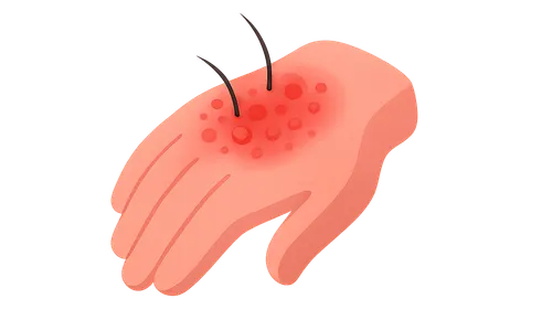 Allergic Contact Dermatitis in Workplace