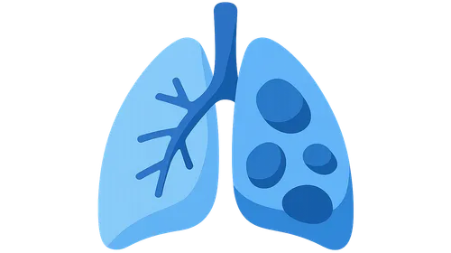 V/Q mismatch in ARDS