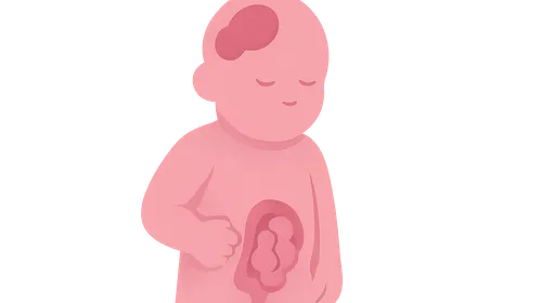 Congenital Anomalies Overview