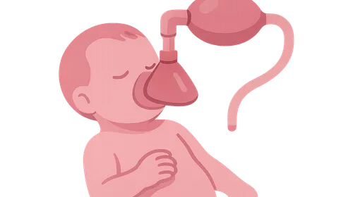 Neonatal Resuscitation