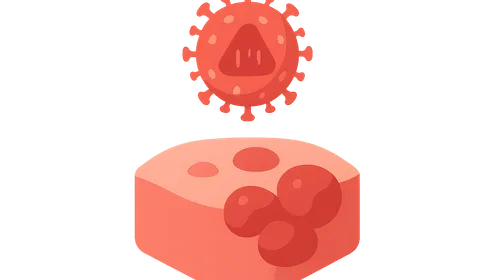 HIV-associated malignancies