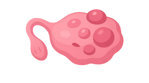 Ovarian Diseases and Tumors