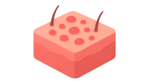 Occupational Infections